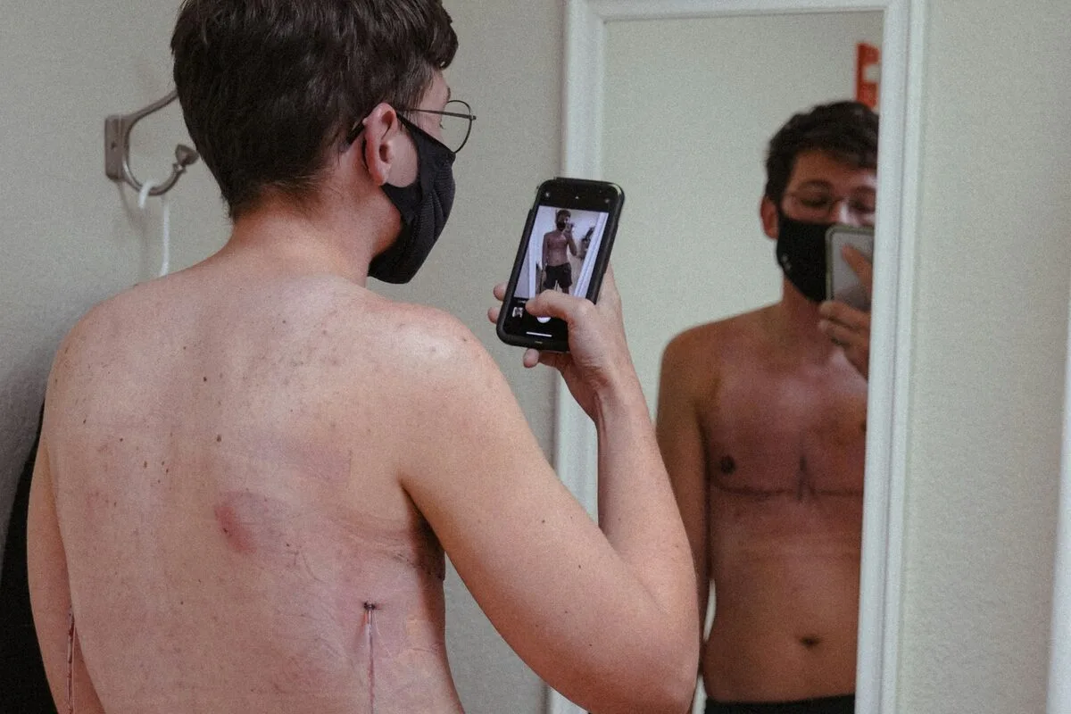 Guide to FTM surgery